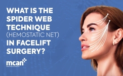 What Is the Spider Web Technique Hemostatic Net in Facelift Surgery en