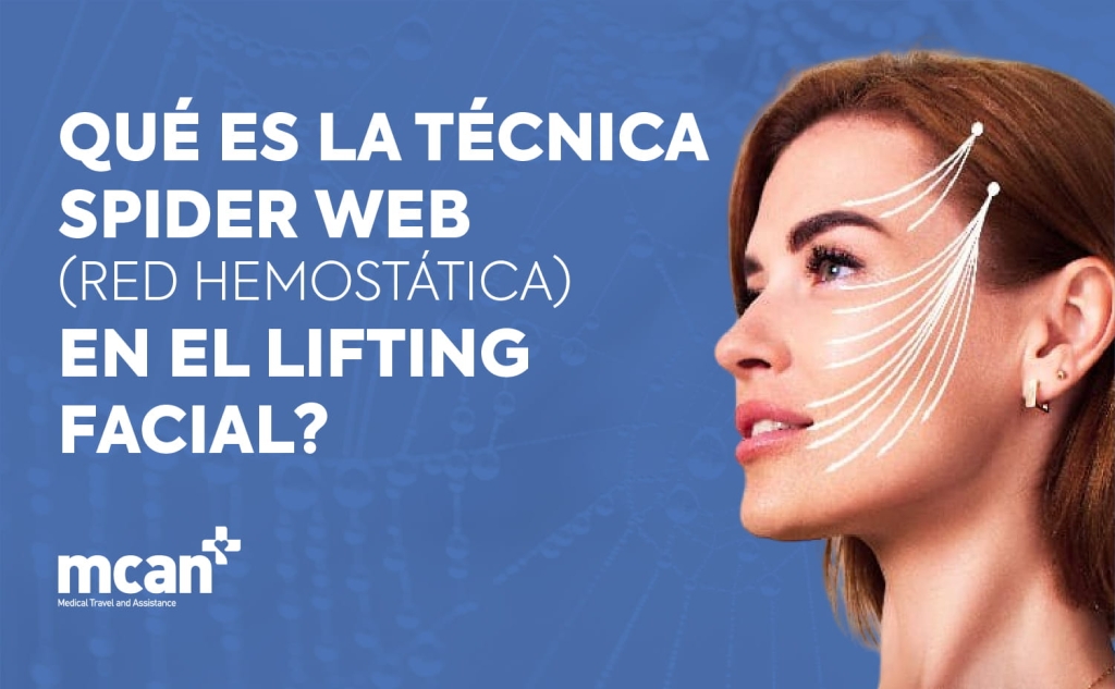 ¿Qué es la técnica Spider Web (red hemostática) en el lifting facial? 1 What Is the Spider Web Technique Hemostatic Net in Facelift Surgery es What Is the Spider Web Technique Hemostatic Net in Facelift Surgery es