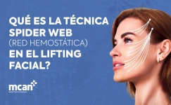 What Is the Spider Web Technique Hemostatic Net in Facelift Surgery es