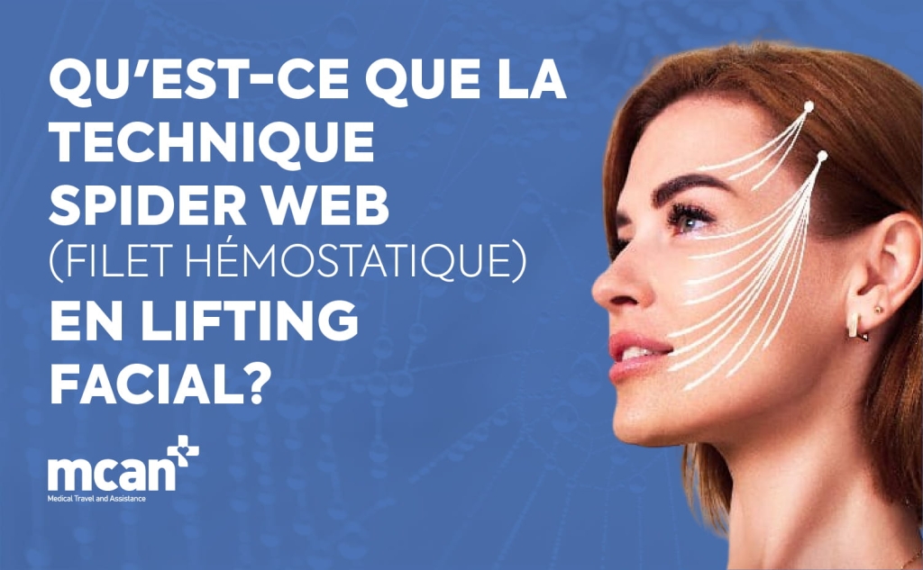 Qu'est-ce que la technique Spider Web (filet hémostatique) en lifting facial ? 1 What Is the Spider Web Technique Hemostatic Net in Facelift Surgery fr What Is the Spider Web Technique Hemostatic Net in Facelift Surgery fr