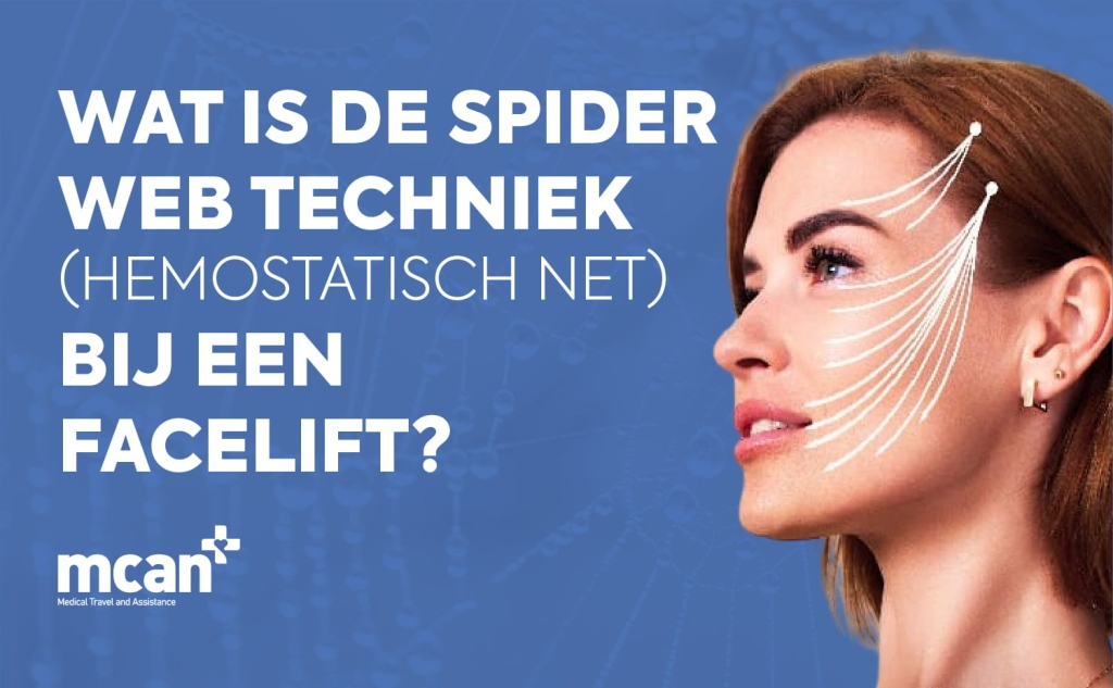 Wat is de spider web techniek (hemostatisch net) bij een facelift? 1 What Is the Spider Web Technique Hemostatic Net in Facelift Surgery nl What Is the Spider Web Technique Hemostatic Net in Facelift Surgery nl