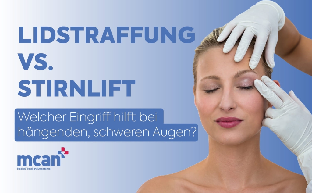 Lidstraffung vs. Stirnlift: Welcher Eingriff hilft bei hängenden, schweren Augen? 1 Blepharoplasty vs. Brow Lift DE 1 Blepharoplasty vs. Brow Lift DE 1