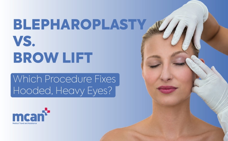 Blepharoplasty vs. Brow Lift: Which Procedure Fixes Hooded, Heavy Eyes?