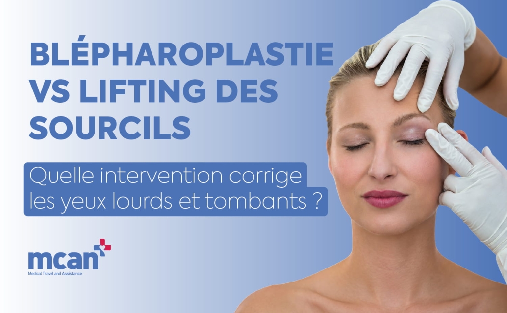 Blépharoplastie vs Lifting des Sourcils : quelle intervention corrige les yeux lourds et tombants ? 1 Blepharoplasty vs. Brow Lift FR 1 Blepharoplasty vs. Brow Lift FR 1