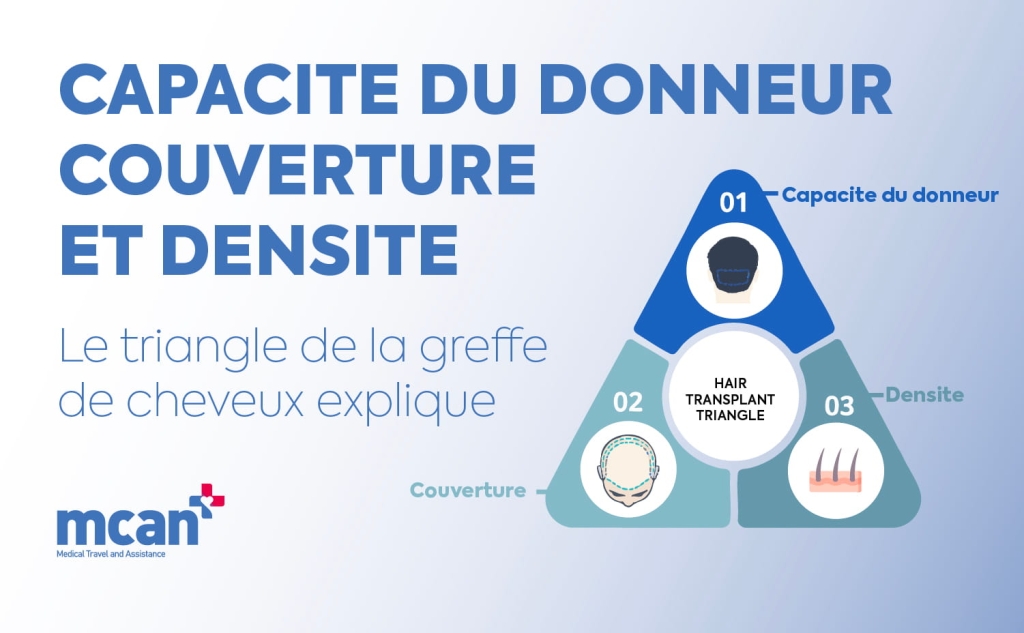 Capacite du donneur, couverture et densite : le triangle de la greffe de cheveux explique 1 Donor Capacity Coverage and Density fr Donor Capacity Coverage and Density fr