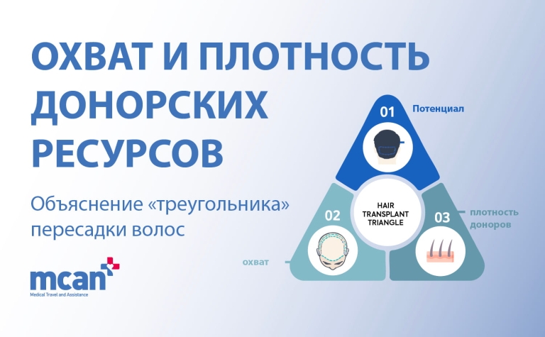 Донорский запас, покрытие и плотность: треугольник трансплантации волос 4 Donor Capacity Coverage and Density ru Donor Capacity Coverage and Density ru