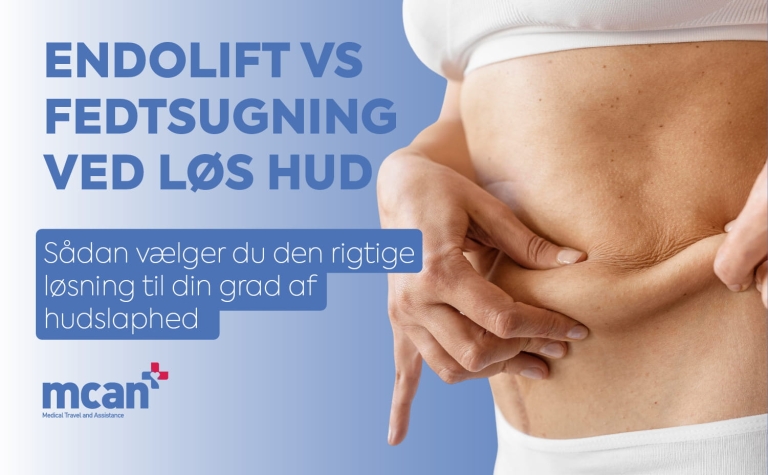Endolift vs fedtsugning ved løs hud: sådan vælger du den rigtige løsning til din grad af hudslaphed 1 Endolift vs Liposuction for Loose Skin da Endolift vs Liposuction for Loose Skin da