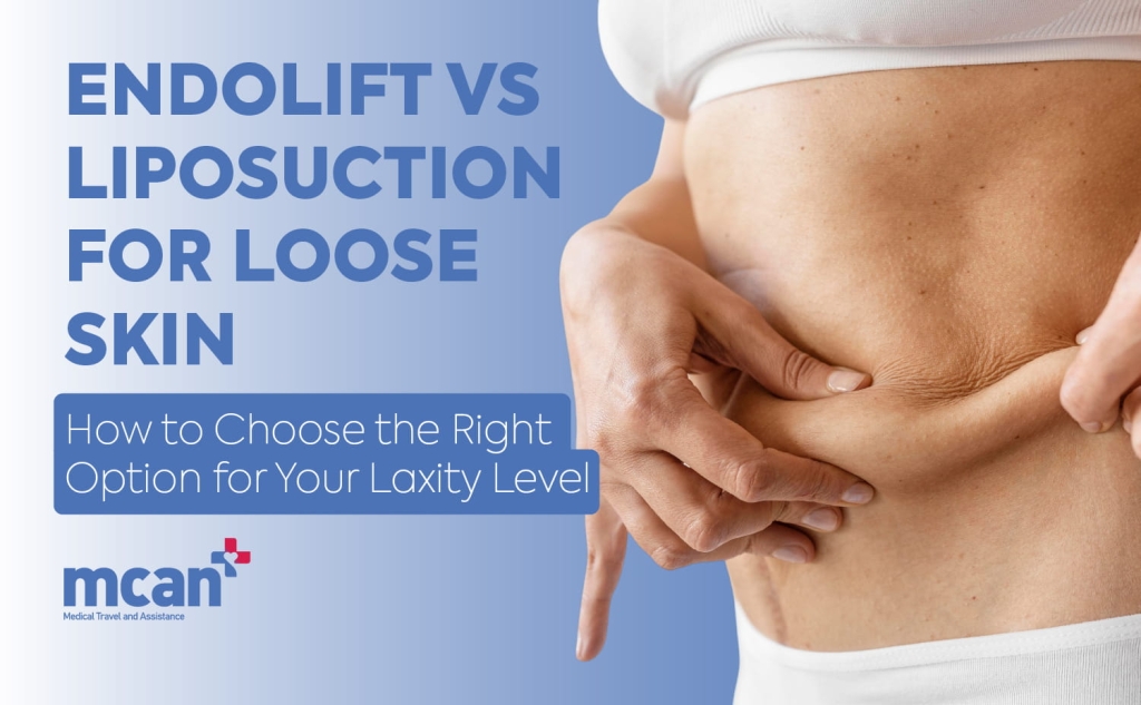 Endolift vs Liposuction for Loose Skin: How to Choose the Right Option for Your Laxity Level 1 Endolift vs Liposuction for Loose Skin en Endolift vs Liposuction for Loose Skin en