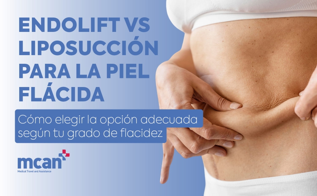 Endolift vs liposucción para la piel flácida: cómo elegir la opción adecuada según tu grado de flacidez 1 Endolift vs Liposuction for Loose Skin es Endolift vs Liposuction for Loose Skin es