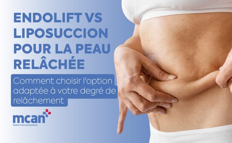 Endolift vs liposuccion pour la peau relâchée : comment choisir l'option adaptée à votre degré de relâchement 3 Endolift vs Liposuction for Loose Skin fr Endolift vs Liposuction for Loose Skin fr