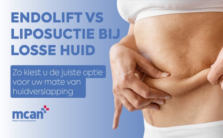 Endolift vs Liposuction for Loose Skin nl