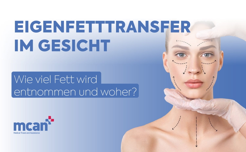 Eigenfetttransfer im Gesicht: Wie viel Fett wird entnommen und woher? 1 Fat Grafting in Facial Surgery de Fat Grafting in Facial Surgery de