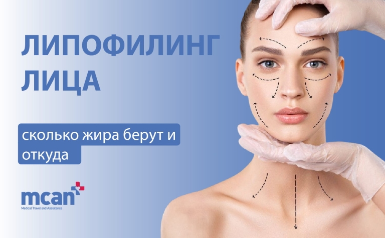 Липофилинг лица: сколько жира берут и откуда 3 Fat Grafting in Facial Surgery ru Fat Grafting in Facial Surgery ru