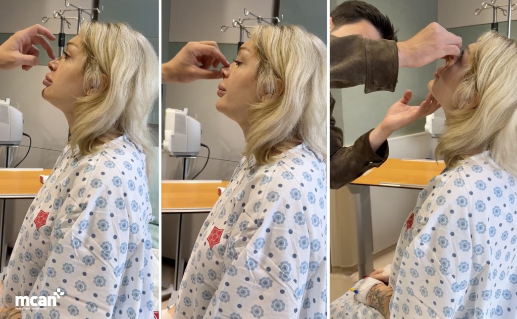 How do our surgeons plan a nose that still looks like you