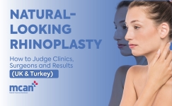 Natural Looking Rhinoplasty en
