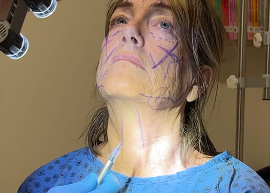 Neck Lift Medical Consultation 1