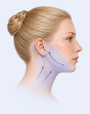 Neck lift with lower face treatment