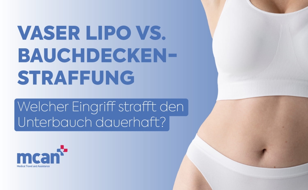 VASER Lipo vs. Bauchdeckenstraffung: Welcher Eingriff strafft den Unterbauch dauerhaft? 1 VASER Lipo vs. Tummy Tuck de VASER Lipo vs. Tummy Tuck de