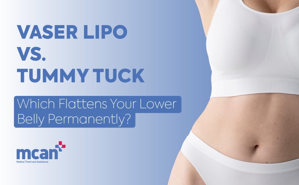 VASER Lipo vs. Tummy Tuck: Which Flattens Your Lower Belly Permanently? 1 VASER Lipo vs. Tummy Tuck en VASER Lipo vs. Tummy Tuck en