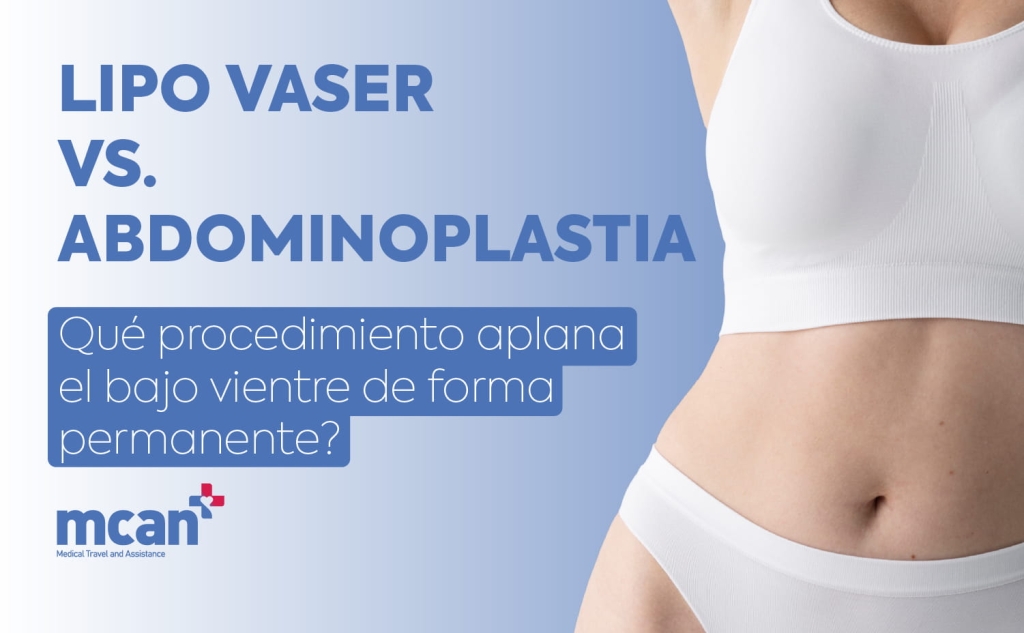 Lipo Vaser vs. Abdominoplastia: ¿qué procedimiento aplana el bajo vientre de forma permanente? 1 VASER Lipo vs. Tummy Tuck es VASER Lipo vs. Tummy Tuck es