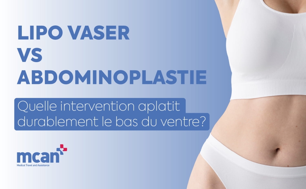 Lipo Vaser vs Abdominoplastie : quelle intervention aplatit durablement le bas du ventre ? 1 VASER Lipo vs. Tummy Tuck fr VASER Lipo vs. Tummy Tuck fr