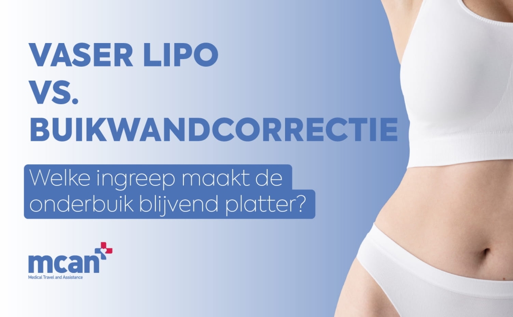 VASER Lipo vs. Buikwandcorrectie: welke ingreep maakt de onderbuik blijvend platter? 1 VASER Lipo vs. Tummy Tuck nl VASER Lipo vs. Tummy Tuck nl