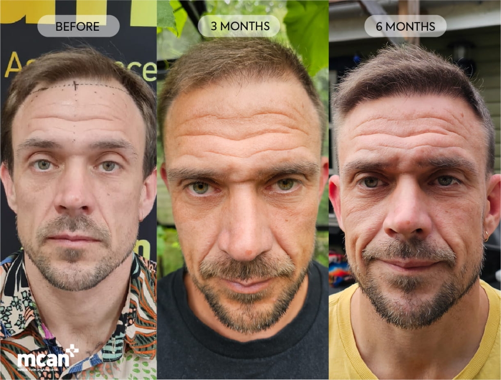 What Recovery and Results Look Like