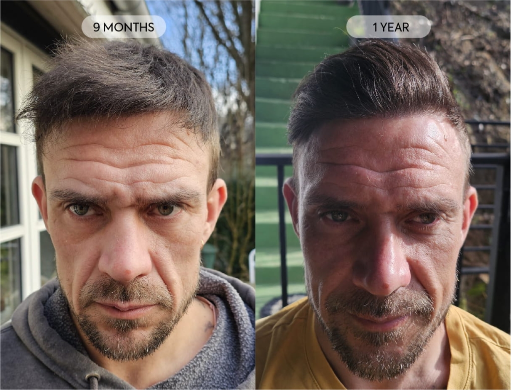 What Recovery and Results Look Like en 2