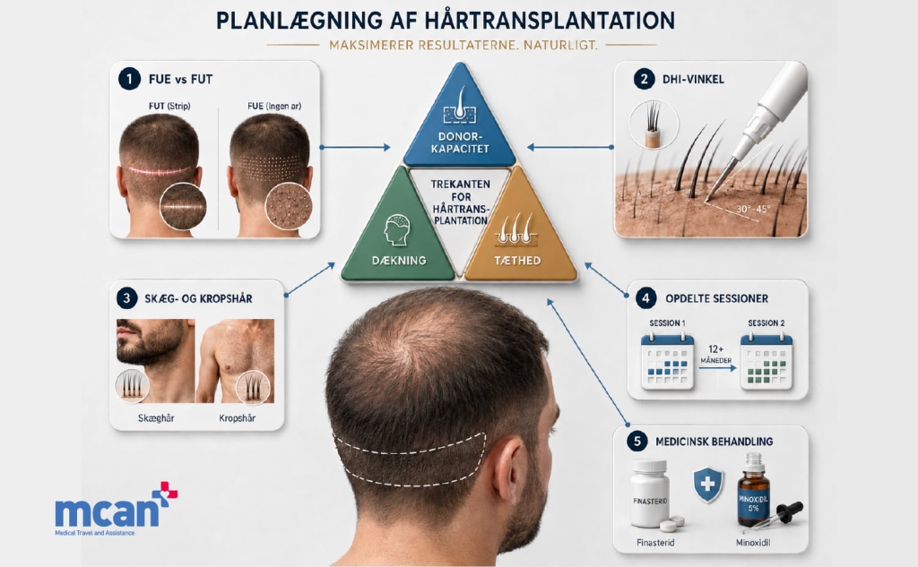 Donorkapacitet, daekning og taethed: hartransplantationens trekant forklaret 4 When the Triangle Does Not Close da When the Triangle Does Not Close da