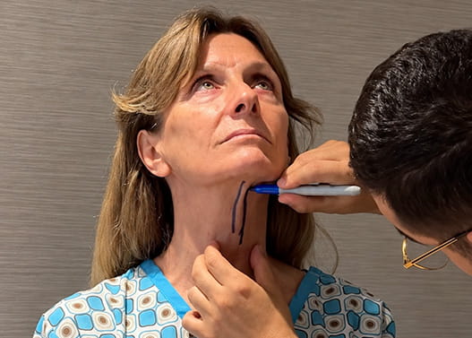 Who Is Suitable for a Neck Lift