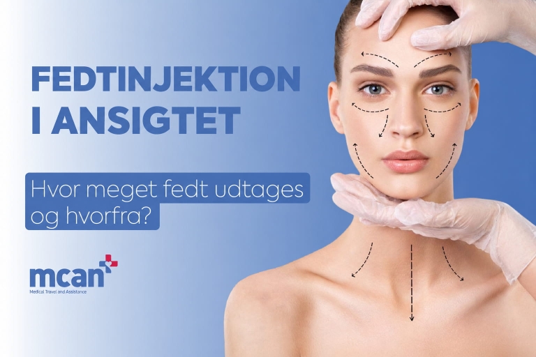 Fedttransplantation i ansigtet: hvor meget fedt tages, og hvorfra? 3 fedt injektion ansigt dansk 1 fedt injektion ansigt dansk 1