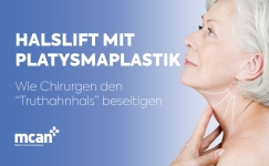 Neck Lift with Platysmaplasty DE