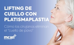 Neck Lift with Platysmaplasty ES