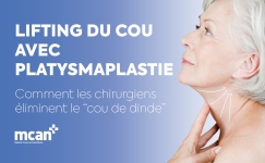 Neck Lift with Platysmaplasty FR 1