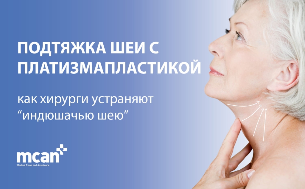 Подтяжка шеи с платизмапластикой: как хирурги устраняют «индюшачью шею» 1 Neck Lift with Platysmaplasty RU Neck Lift with Platysmaplasty RU