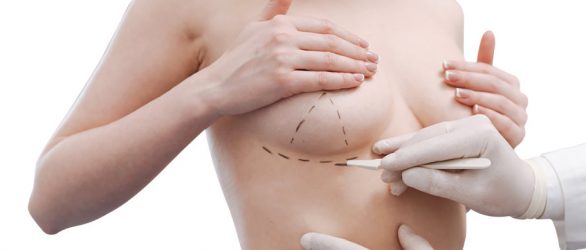 Breast Reduction Turkey