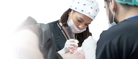 FUE Hair Transplant Turkey