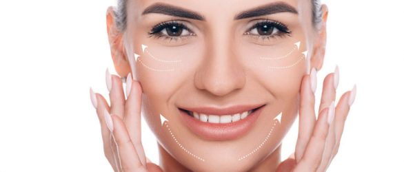 Facelift (Rhytidectomy) in Turkey