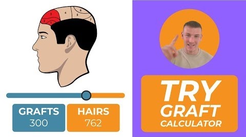 hair graft calculator tool